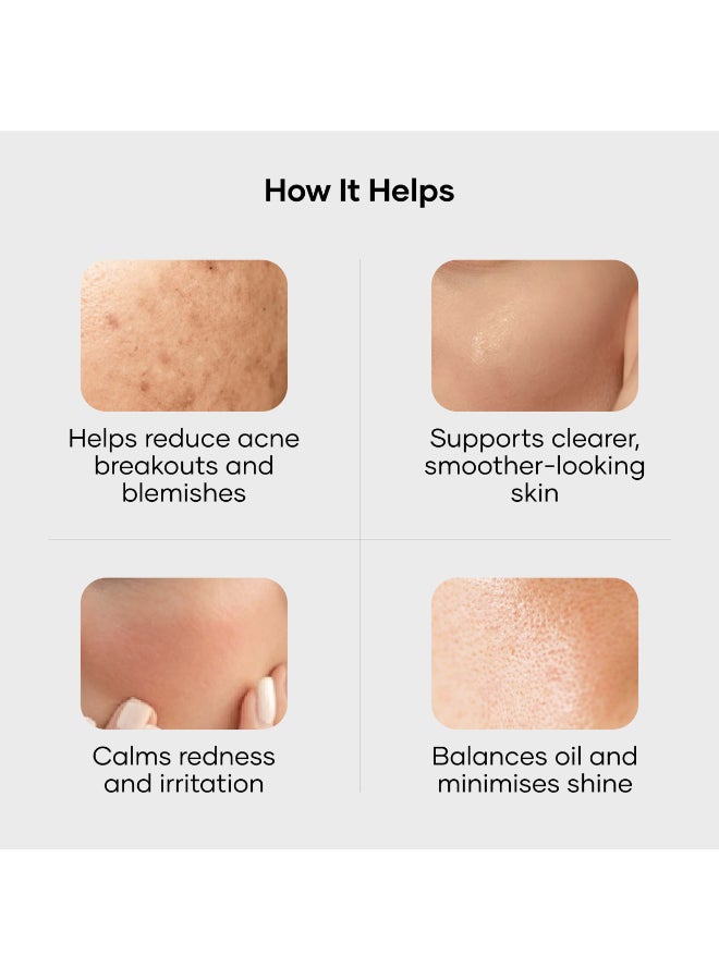 Cureskin AMP Advance Gel | Clarifying Gel for Face and Body | Smooths and Soothes Blemish-Prone Skin, 15 g (Pack of 1) - Image 5
